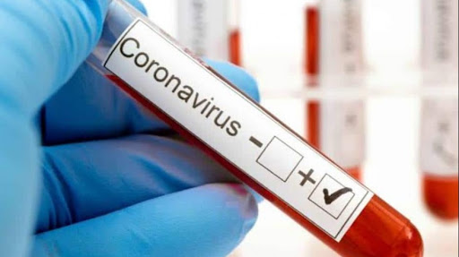 41 nuevos casos de covi19 positivos en la provincia